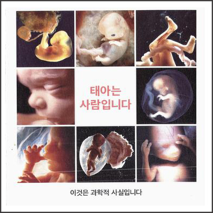 태아는 사람입니다