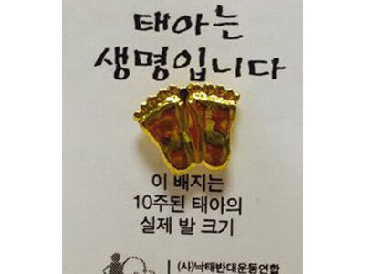 10주 된 태아 발배지